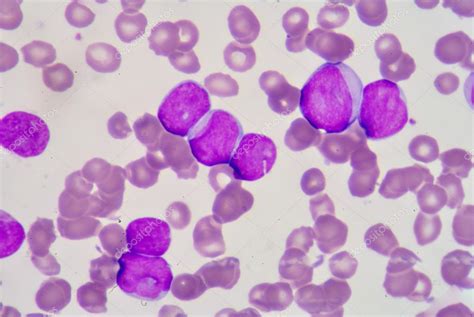 Lymphoblaste — Stock Photo © toeytoey #63120231