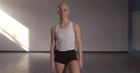 Why Is Madison Jordan Bald? The 'SYTYCD' Contestant's Inspiring Story