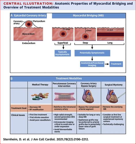 Myocardial Bridging: Diagnosis, Functional Assessment, and Management ...