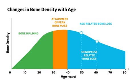 Osteoporosis Treatment - Naturally Increase Bone Density | AlgaeCal