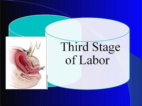 Third stage of labor for undergraduate