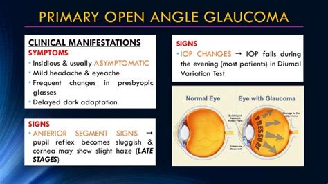 Primary Glaucoma