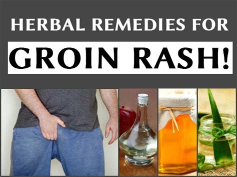 Herbal Remedies For Groin Rash! - Boldsky.com