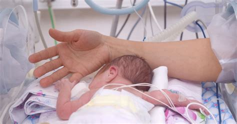 Extremely premature babies may face lifelong challenges - CBS News