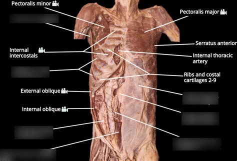 Muscles Of The Trunk Anterior View