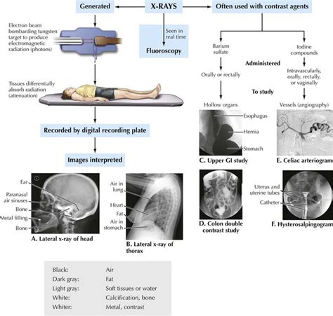 Introduction to Imaging Modalities | Radiology Key