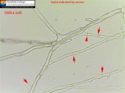 Scanning Electron Microscope Blog: A Few More Fungi