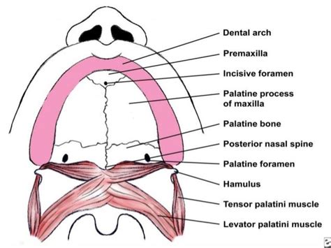 Cleft lip and Cleft palate embryology, features, and management