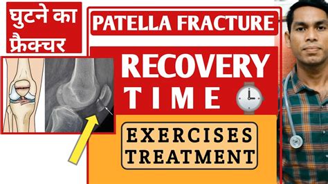 Patella fracture recovery time after surgery, knee fracture recovery exercises, in hindi ...