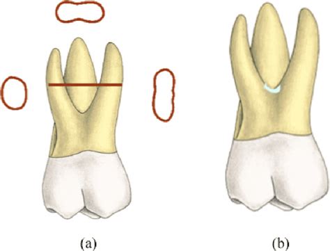 3d tooth atlas free download - azgardeditor