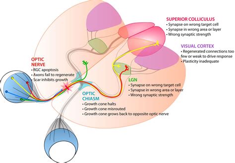 Reconnecting Eye to Brain | Journal of Neuroscience