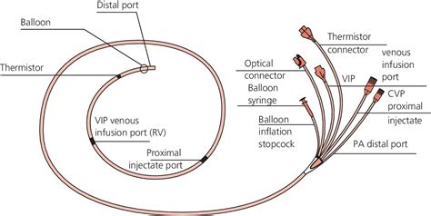 2: The nuts and bolts of right heart catheterization and PA catheter placement | Thoracic Key