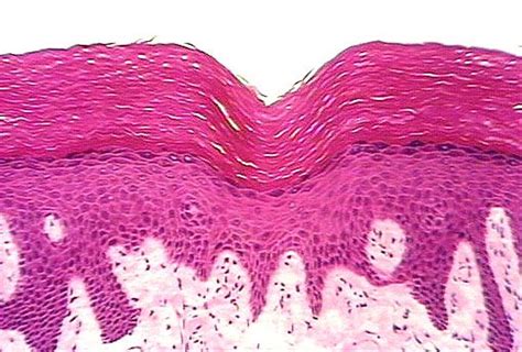 Keratinized Stratified Squamous Epithelium - Anyatrust