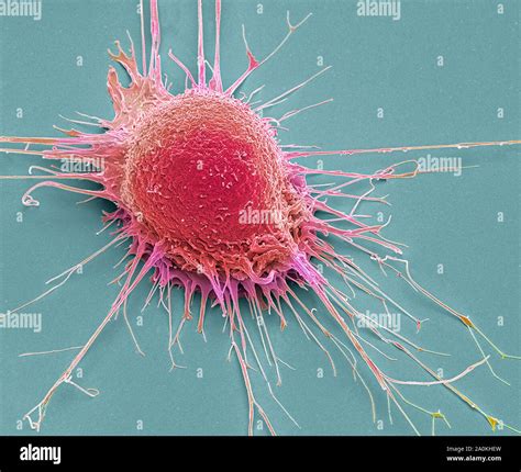 Prostate cancer cell, SEM Stock Photo - Alamy