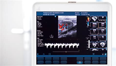 Double-check Duplex Scan Documentation - AAPC Knowledge Center