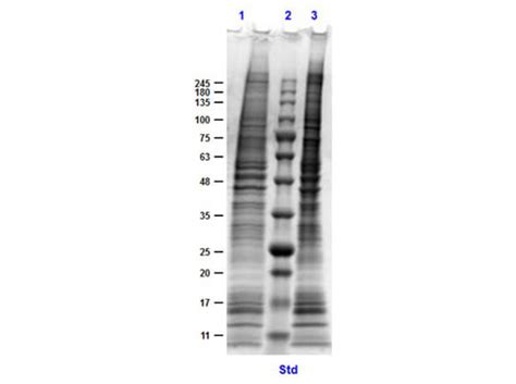 MDA-MB-231 Whole Cell Lysate (W09-001-GK6) | Rockland