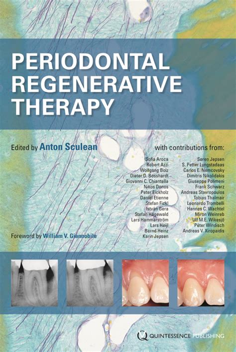 Periodontal Regenerative Therapy - Dentalbookshop