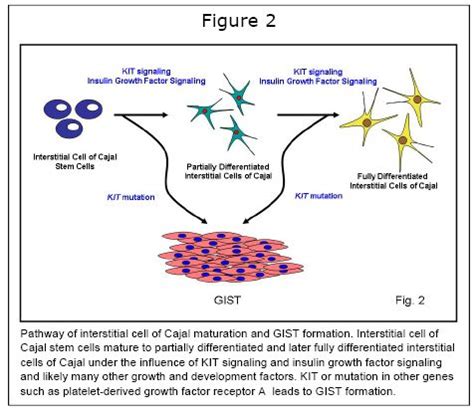 Interstitial cells of Cajal: What are they and why should you care ...