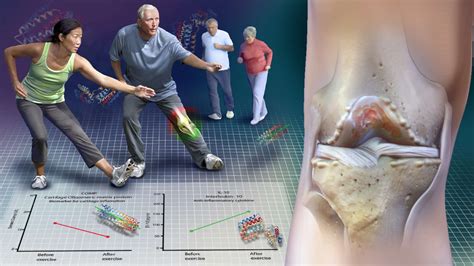 Exercise and Knee Arthritis Pain: The science of why it works.