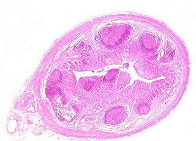 Appendix Histology - Appendix - histology slide