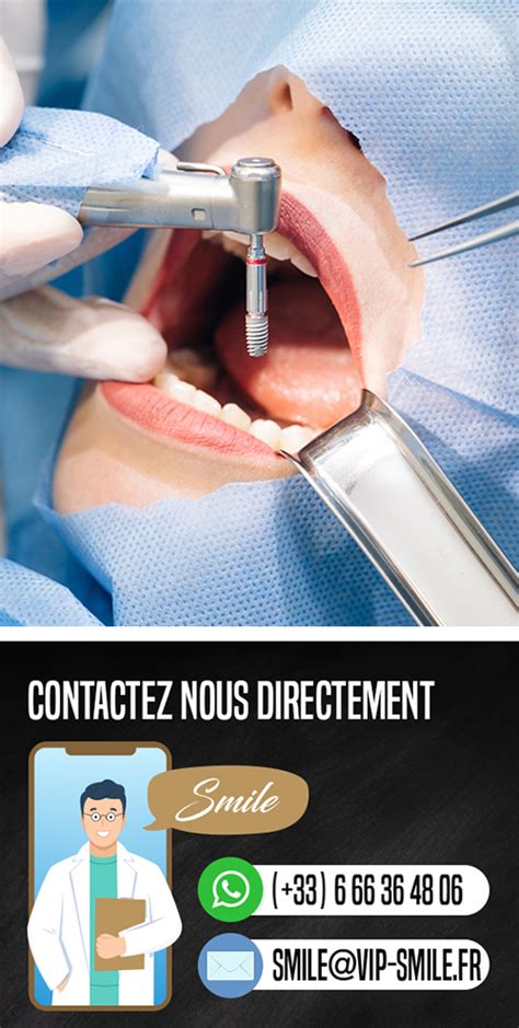 Implant dentaire - VIP Smile - Implant dentaire et facette dentaire Tunisie