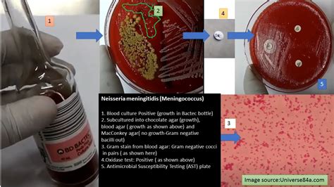 Meningococcus: Introduction, Culture characteristics, Pathogenesis,