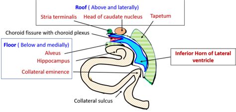 Lateral Ventricle - Anatomy QA