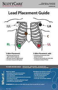 Holter Monitor Lead Placement Diagrams