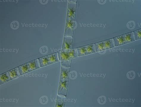 Green algae at high magnification under the microscope 12871398 Stock ...