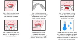 Teeth Whitening - At Home Instructions | Ewan Bramley Dental Care