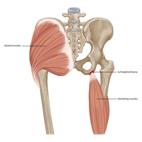 Ischial Pain When Sitting