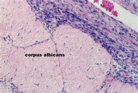 Ovary, Postovulation | Microanatomy Web Atlas | Gwen V. Childs, Ph.D.