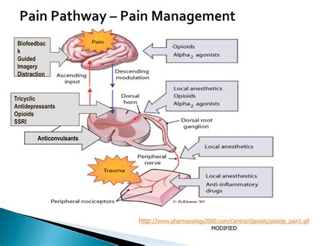 Pain Pathway Concept Maps