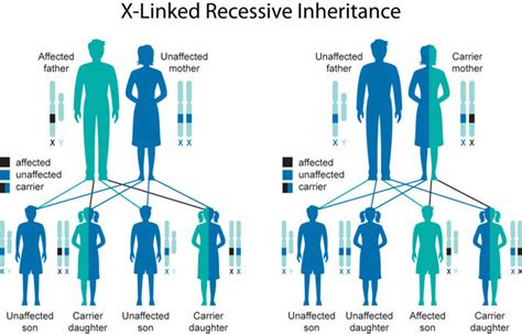 Duchenne muscular dystrophy causes, symptoms, diagnosis, treatment ...