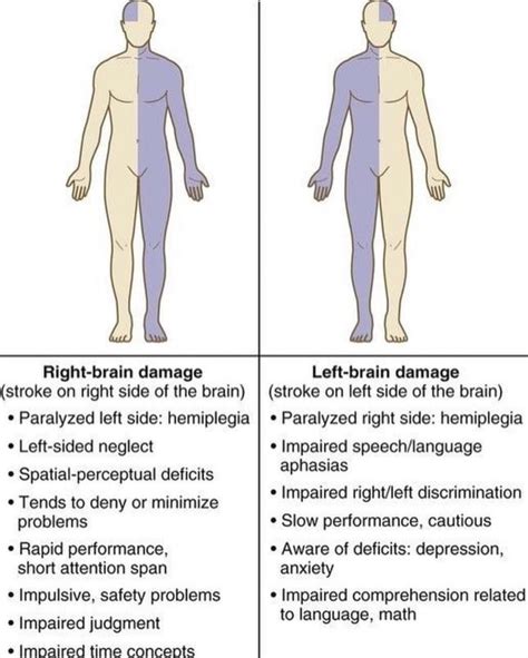 Right-brain damage (stroke on right side of the brain) Paralyzed left side: hemiplegia Left ...