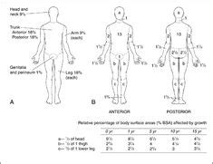 Total Body Surface Area illustration of the Rule of Nine, adult and child diagrams | Rule of ...