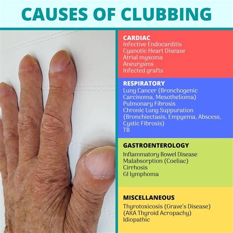 Causes of Clubbing | Pulmonary fibrosis, Graves disease, Inflammatory bowel disease