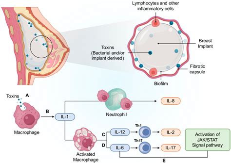 Cancers | Free Full-Text | Anaplastic Large Cell Lymphoma: Molecular ...