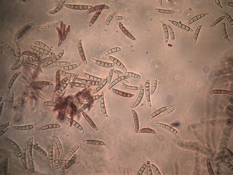 MaxwellHandiseniPLPA631: Lab 5: Conidiating Fungi