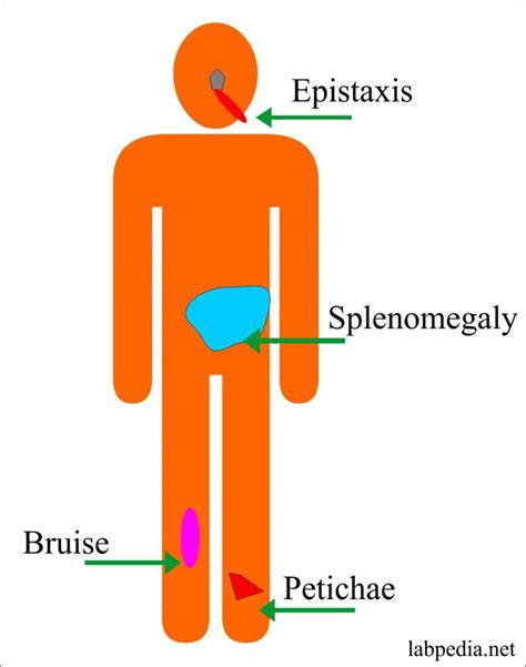 Polycythemia (Erythrocytosis), Polycythemia Rubra Vera, and Secondary ...