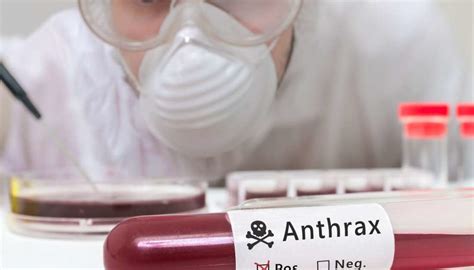 Anthrax: Causes, treatments, and risks