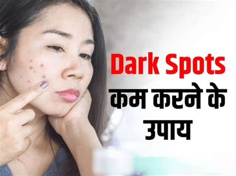 चेहरे पर डार्क स्पॉट्स से हैं परेशान तो इस तरह की डाइट लेना करें ...