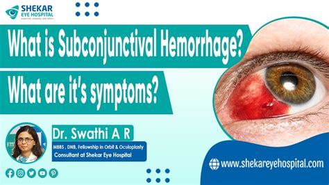 Subconjunctival Hemorrhage (Blood in Eye) | Symptoms, Signs & Causes of ...