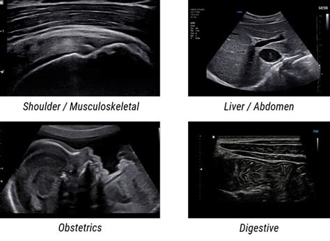 Ultrasound Physics - Medical Professionals