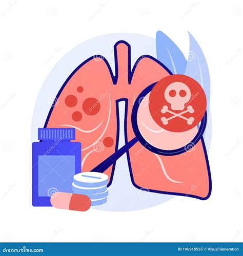 Lower Respiratory Infections Abstract Concept Vector Illustration ...