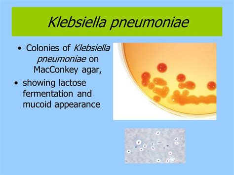 Antibiotics for klebsiella pneumonia