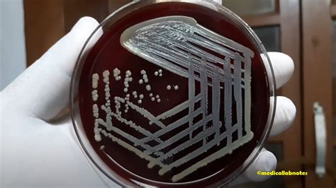 Staphylococcus epidermis colony morphology on blood agar Archives - Medical Notes