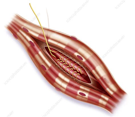 Muscle spindle - Stock Image - C004/0776 - Science Photo Library