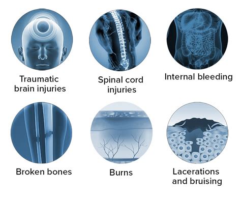 Bicycle Accident Injuries - The Advocates