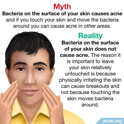 Acne Myths - Acne.org